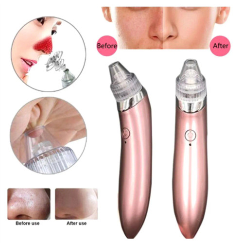 دستگاه میکرودرم خانگی مدل XN-8030