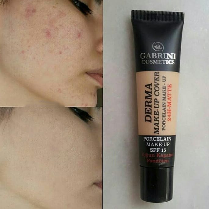 کرمپودر گابرینی GABRINI DERMA حجم40ml اورجینال